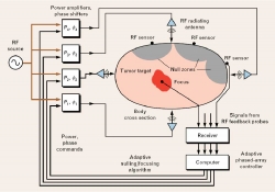 Principles and application of rf system for hyperthermia therapy