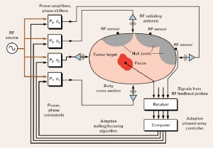 Principles and application of rf system for hyperthermia therapy